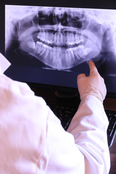Best Tooth Infection Emergency Dentist  in Wells Branch, TX